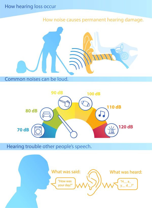 Illustration of how hearing loss occurs, showing the damage to hair cells in the inner ear caused by high decibel levels
